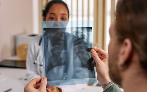 Рак легенів | © Pexels