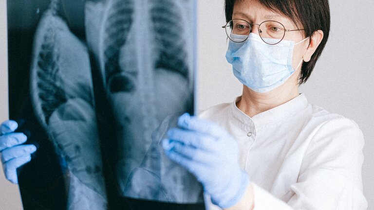 Рак легенів - рентген | © Pexels